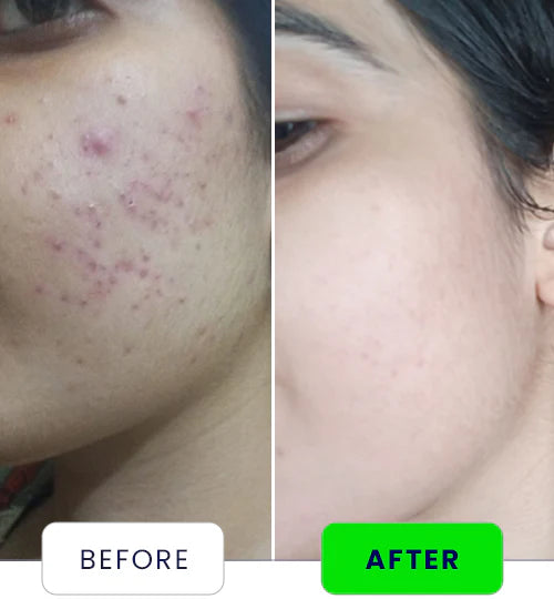 Amazing product!